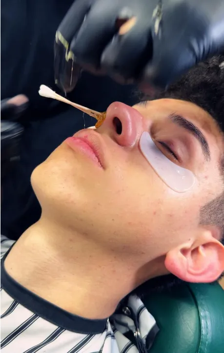 Depilación Nasal