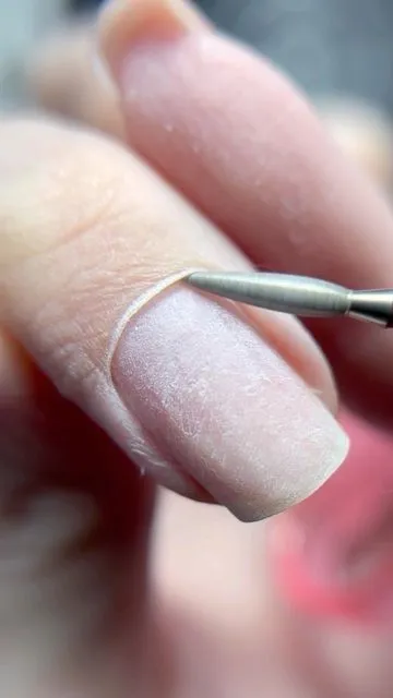 RETIRO DE SEMIPERMANENTE - Imagen 1