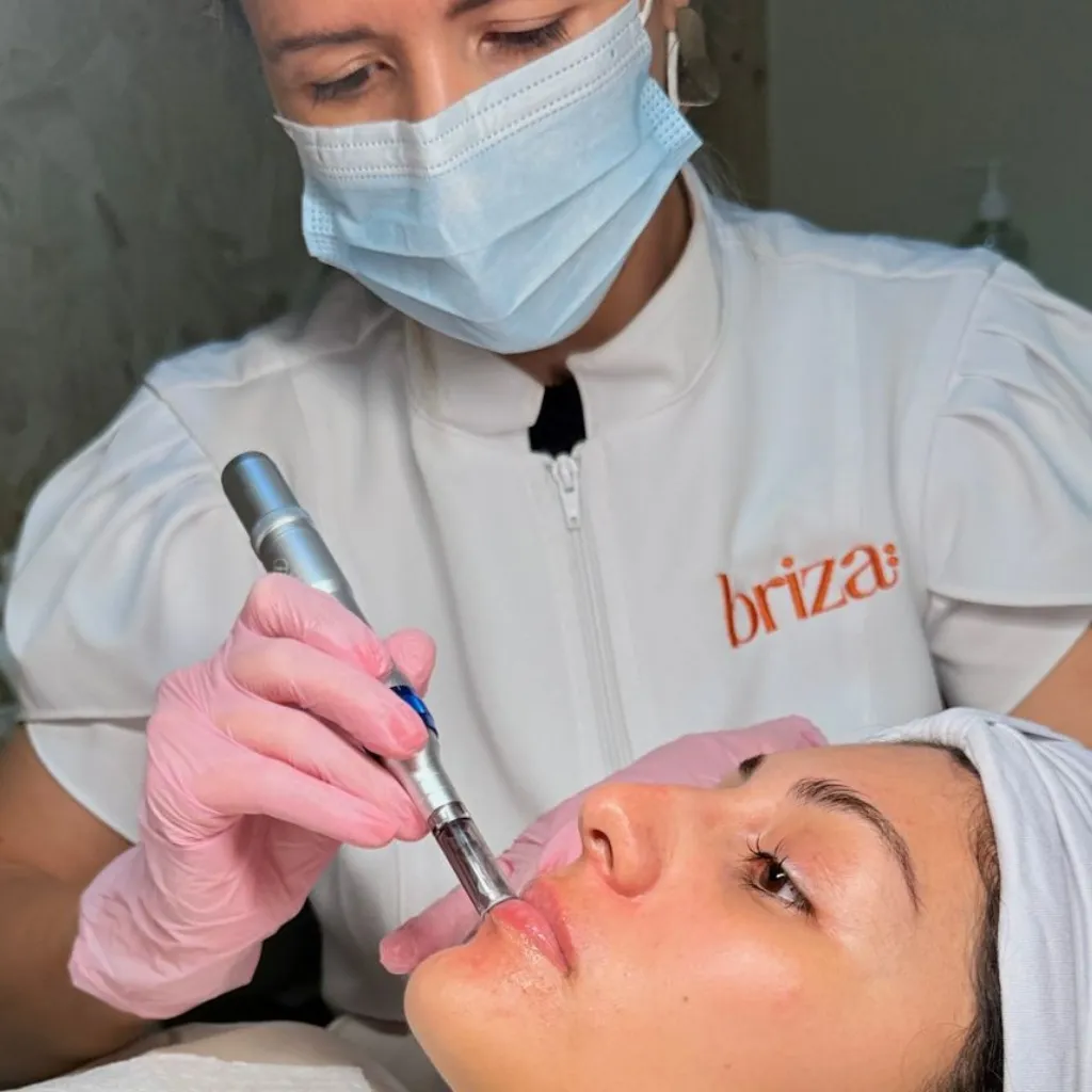 Lip glow labial con microneddling