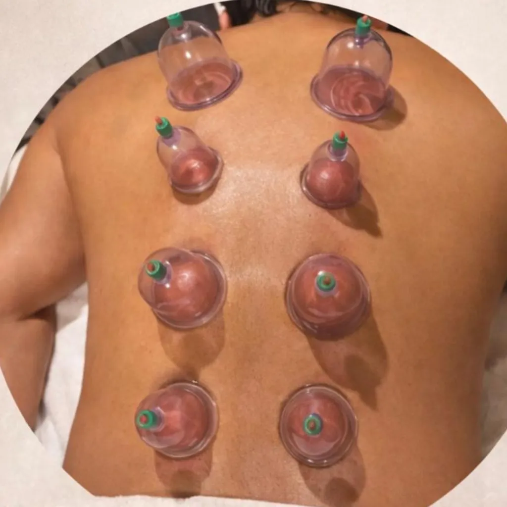 Masaje Con Ventosas