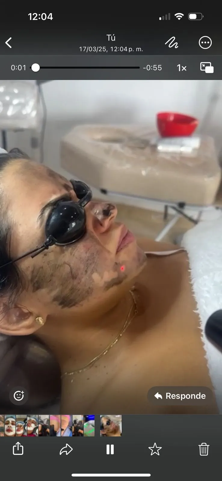 Hollywood peeling - Imagen 1