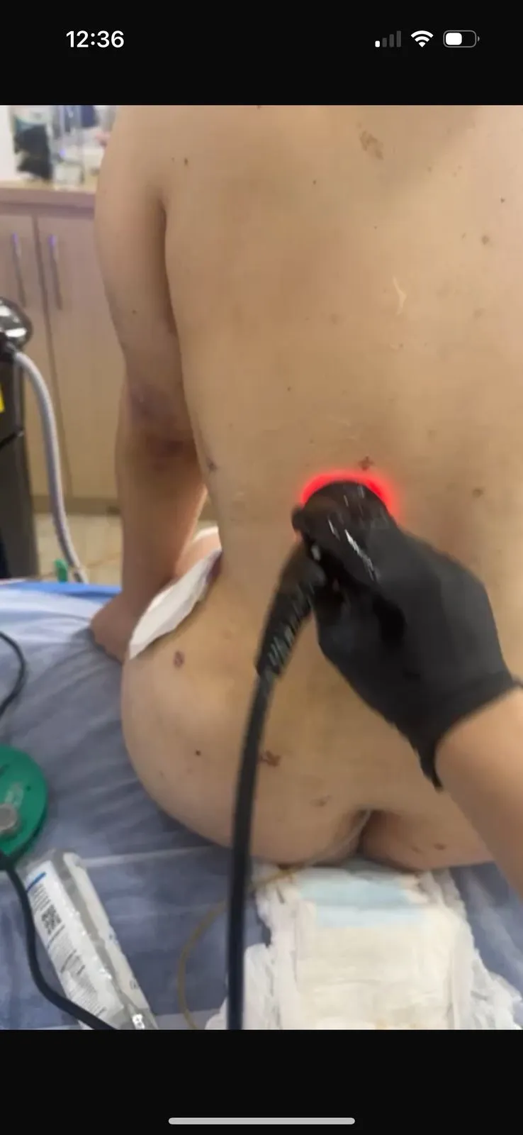 Post operatorio x 10 sesiones