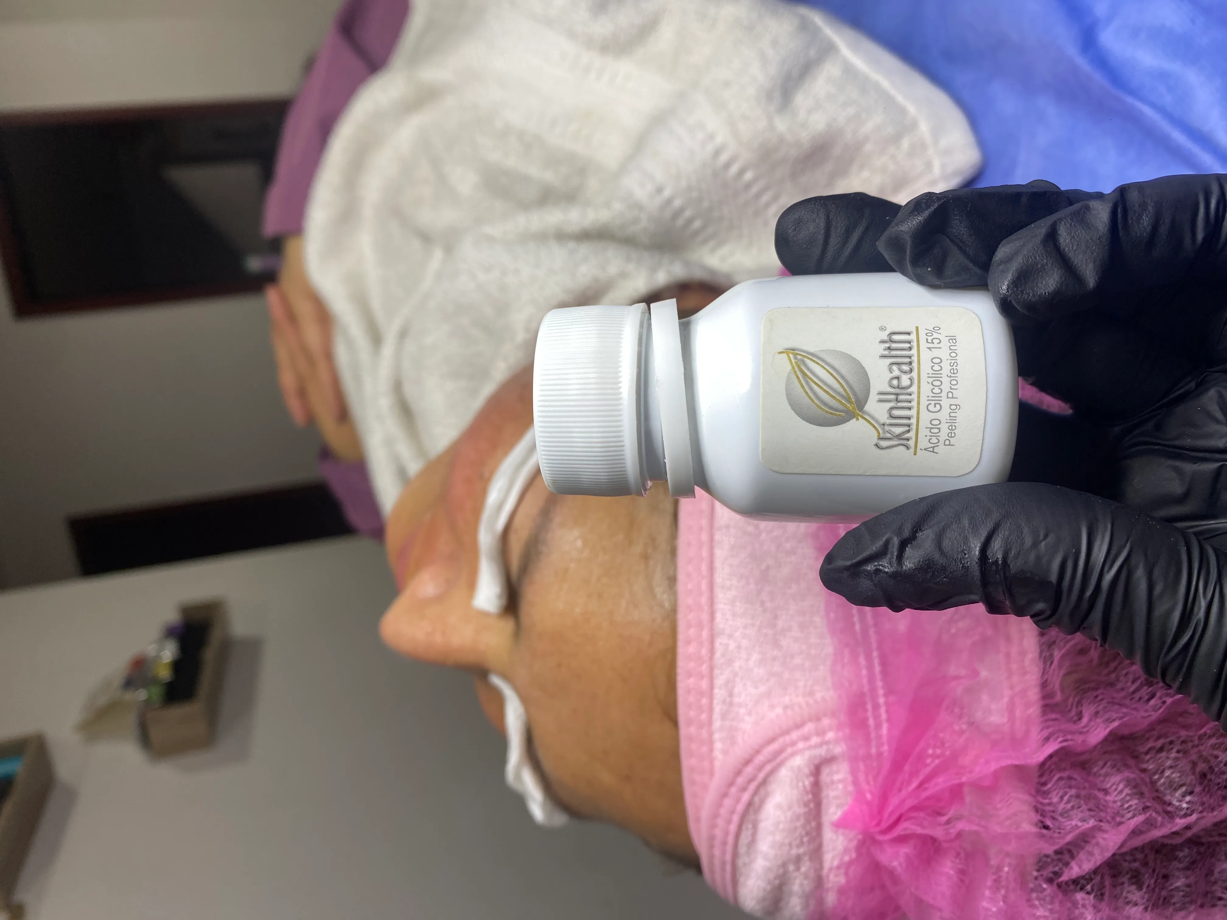 Porcelanización facial - Imagen 1