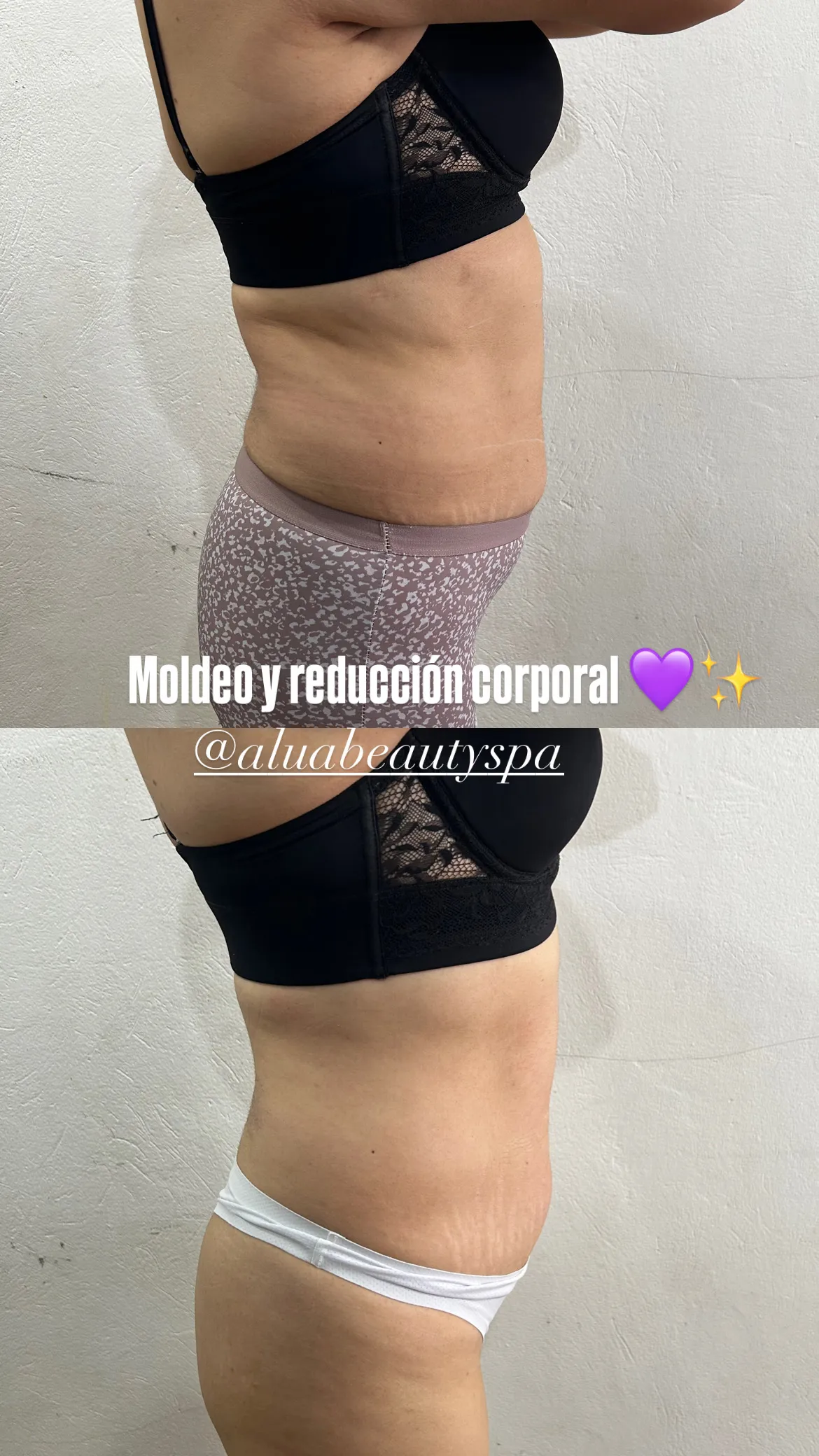 Paquete de moldeo y reducción corporal 🙌