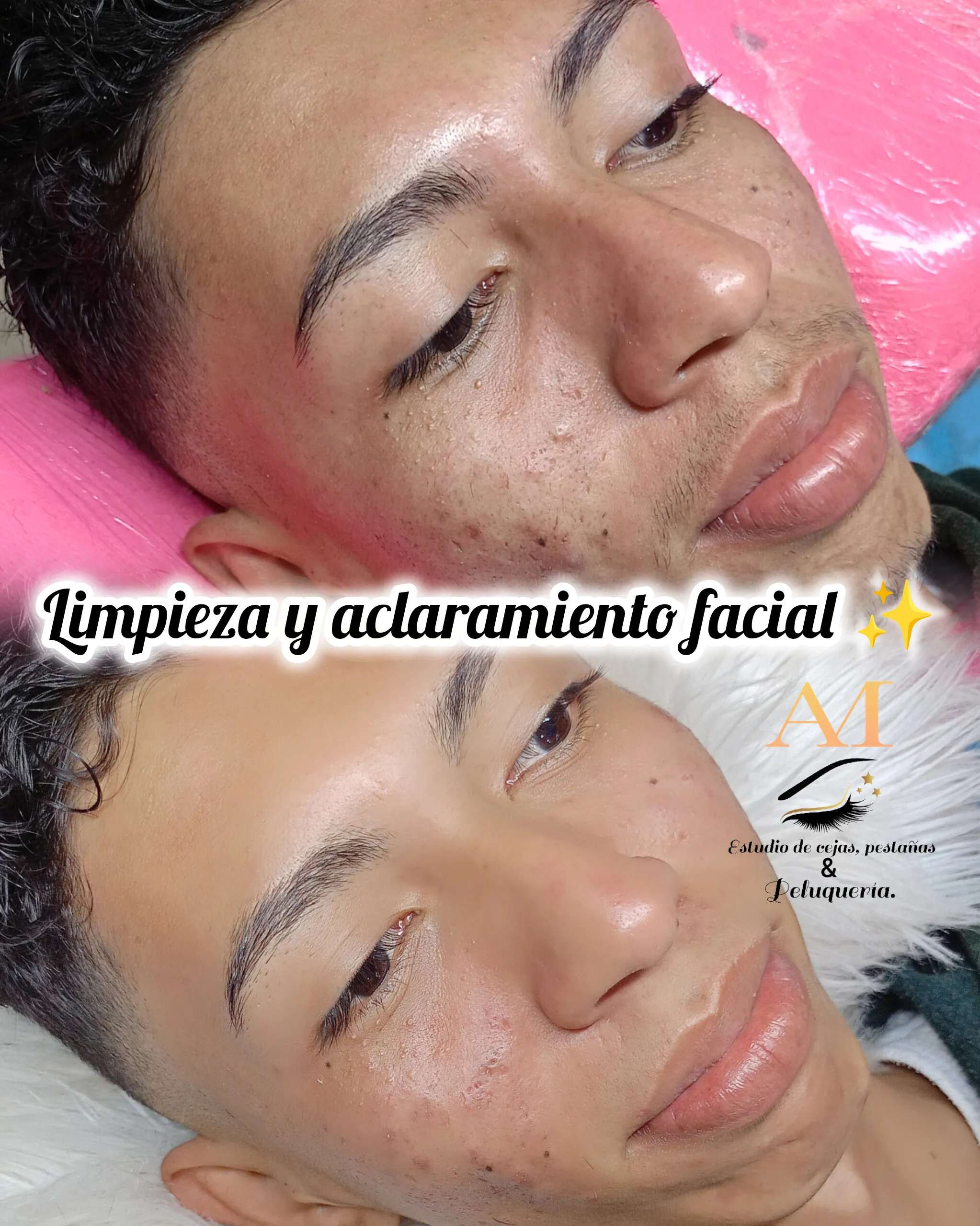 limpieza facial ✨