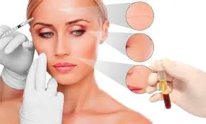 PLASMA RICO EN PLAQUETAS - Imagen 1