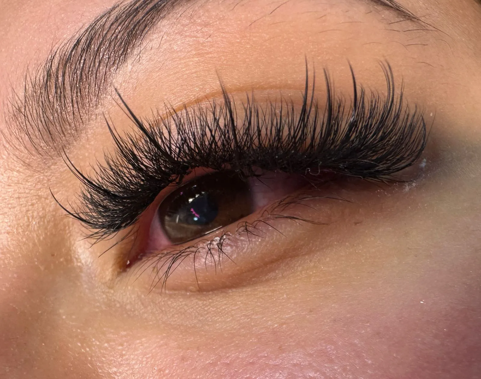  Técnica wispy