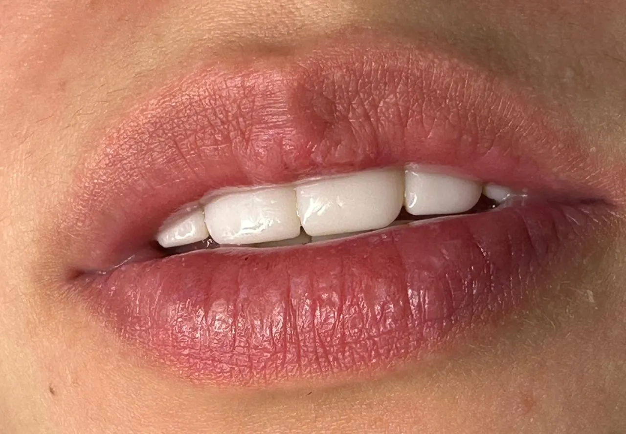 Micropigmentación de labios 