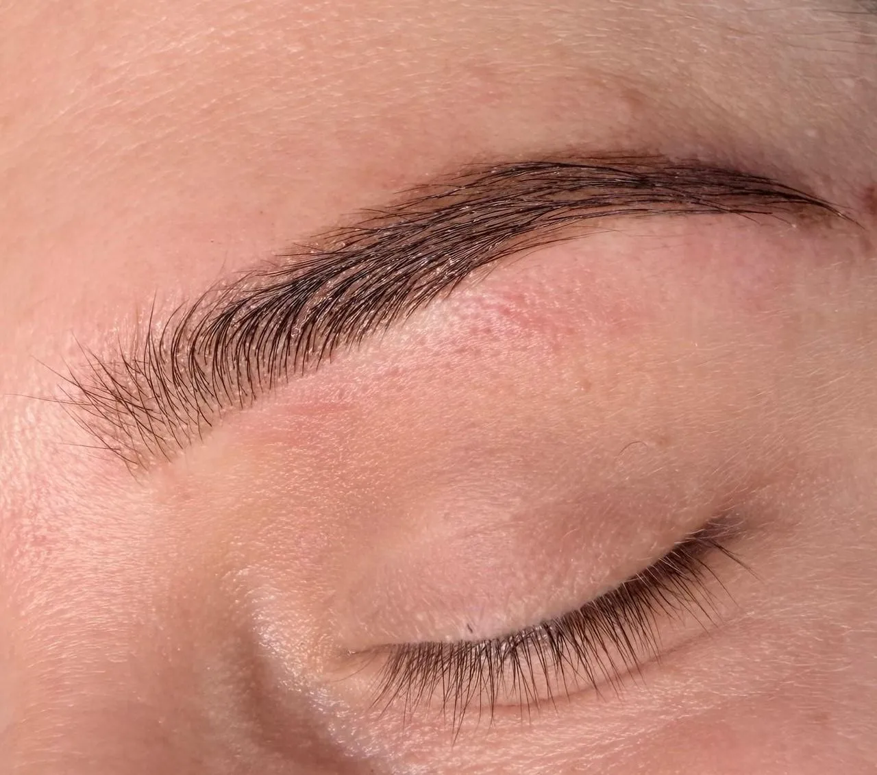 Pigmentación de gena 