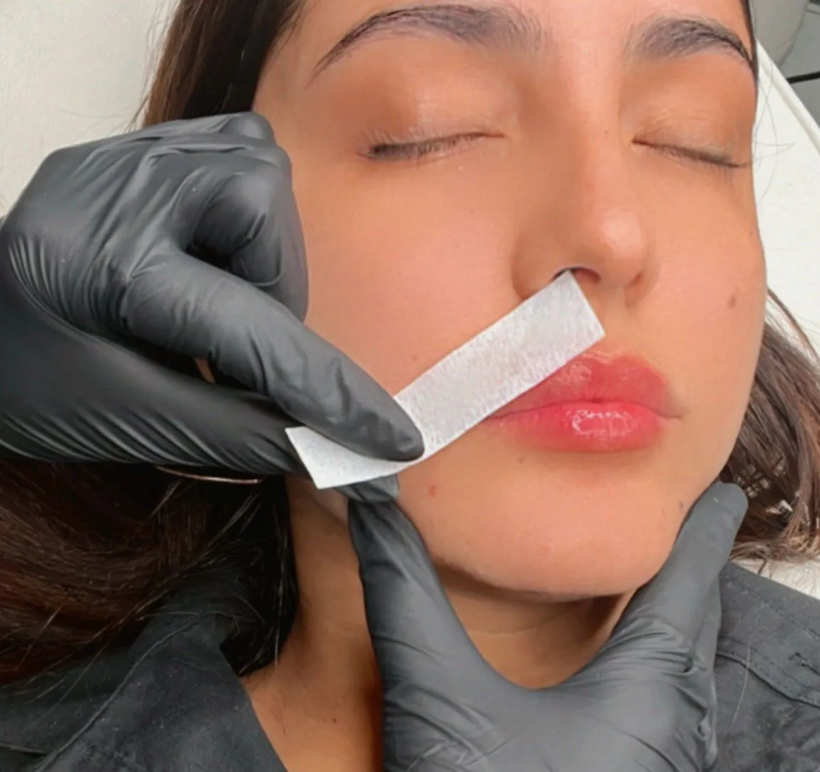 Depilación Facial