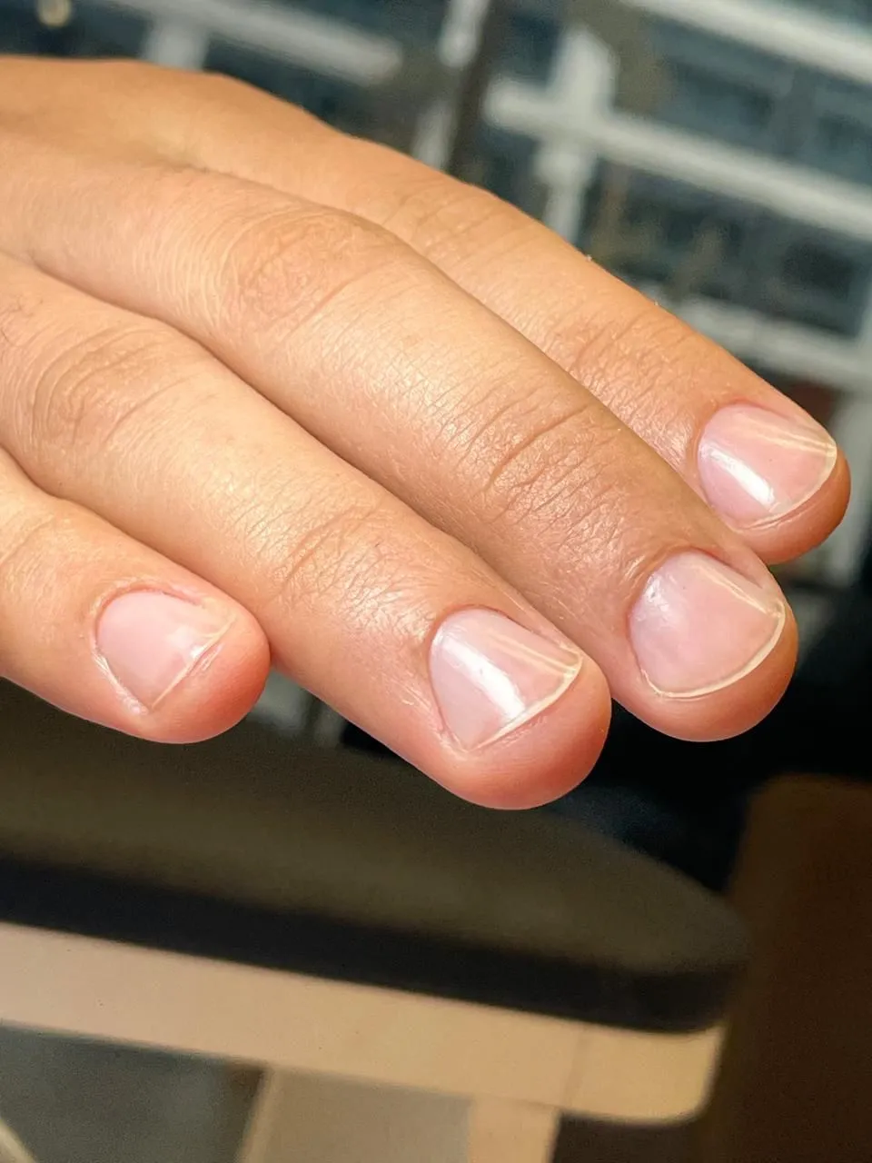 Stop Uñas Mordidas - Imagen 1