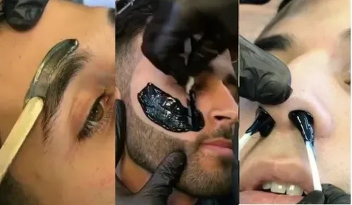 Depilación Facial