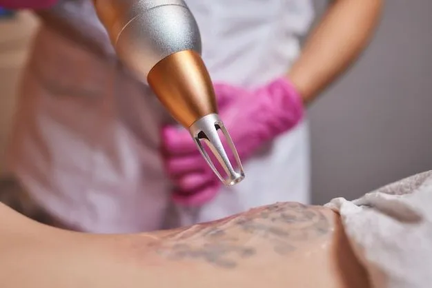 Eliminación de tatuajes  - Imagen 1