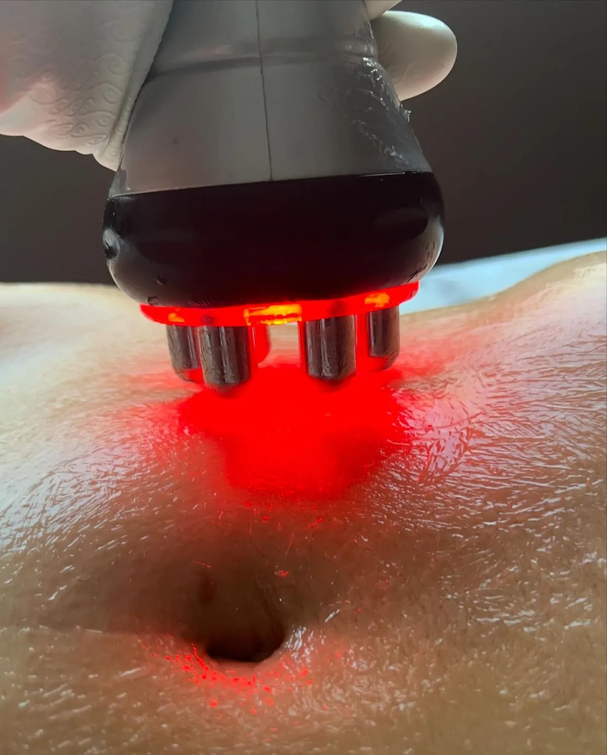 Lysis Detox - Imagen 1