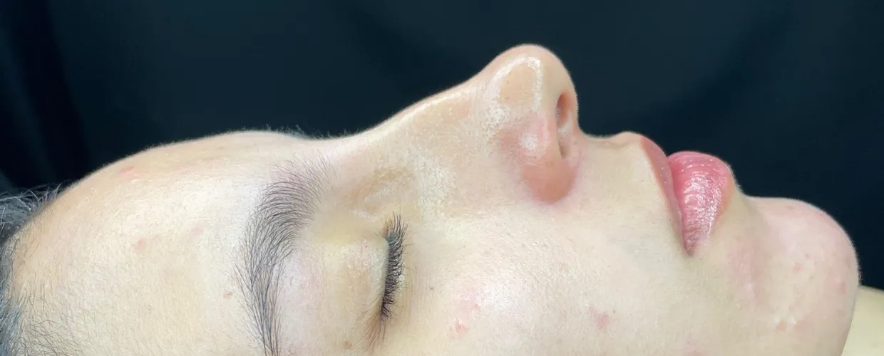 Limpieza facial Glowy  - Imagen 1