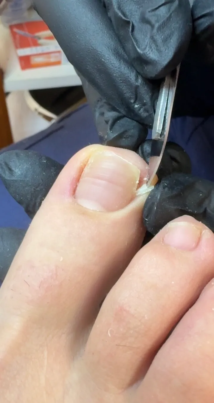 Pedicuría (𝟐𝟎% 𝐨𝐟𝐟 𝐝𝐢́𝐚𝐬 𝐦𝐢𝐞𝐫𝐜𝐨𝐥𝐞𝐬)