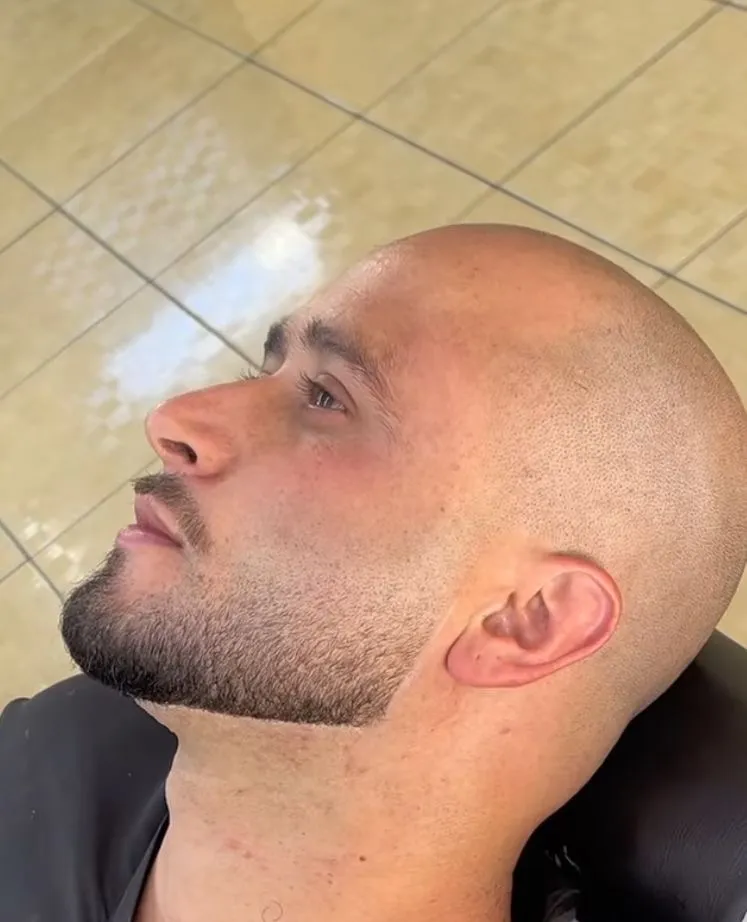 Rapado+Barba