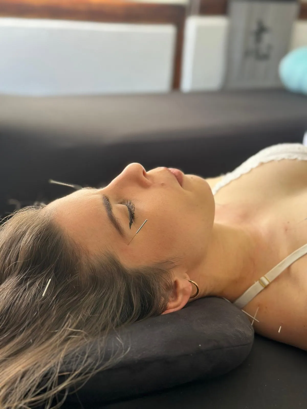 Consulta Médica y Acupuntura  - From