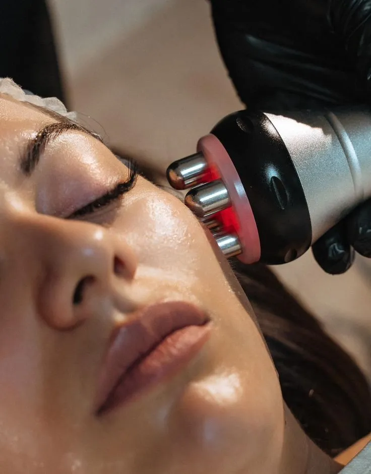REJUVENECIMIENTO FACIAL CON RADIOFRECUENCIA