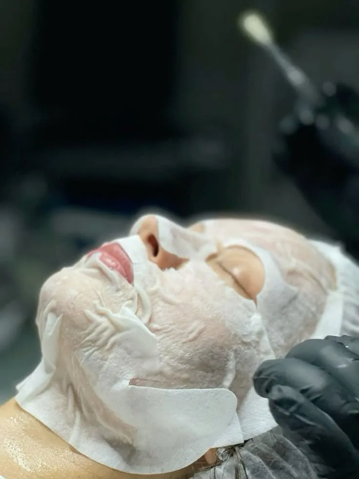 CARBOXITERAPIA FACIAL