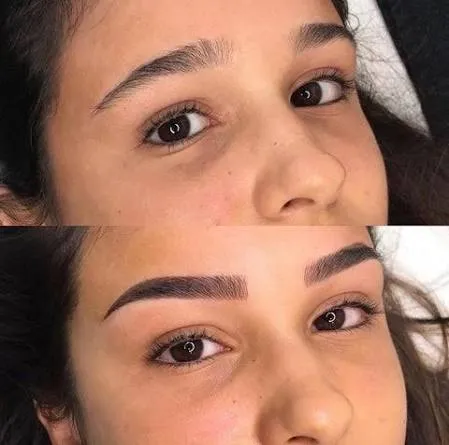 Microblading