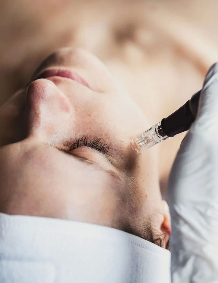 TRATAMIENTO FACIAL CON EXOSOMAS
