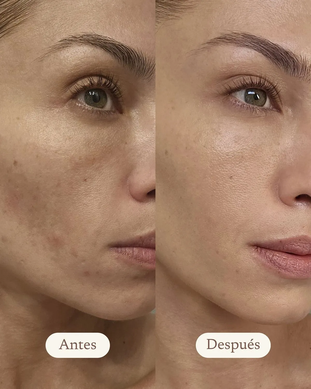 LIMPIEZA FACIAL DESPIGMENTANTE - Imagen 1