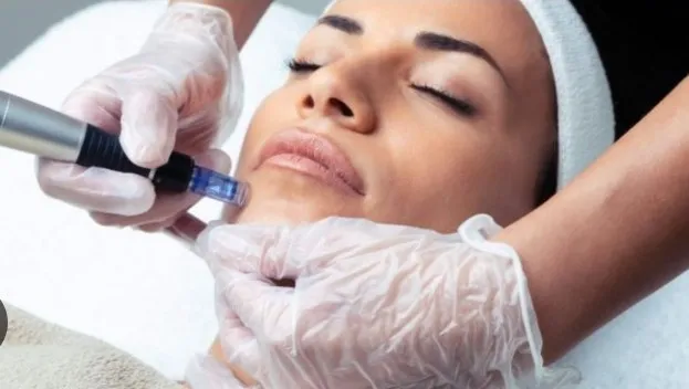 Limpieza Facial + Hidratación con Dermapen