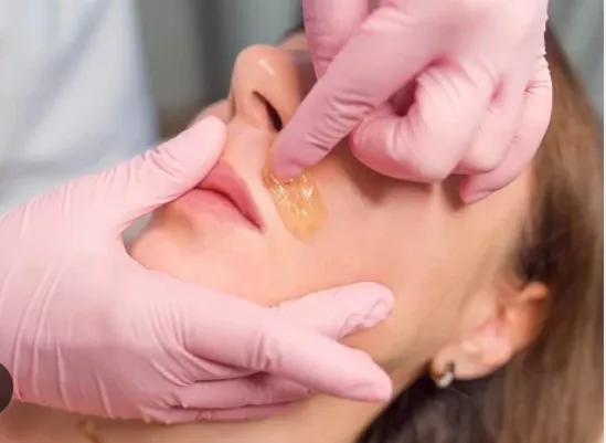 Depilación bozo (Hombre y mujer) - Imagen 1