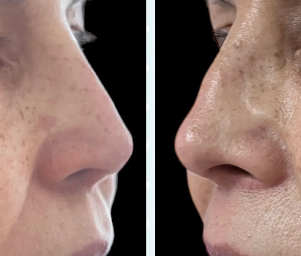 Rinomodelaciòn - Imagen 1