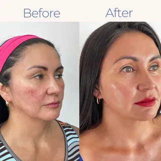 Polinucleotidos - Imagen 1