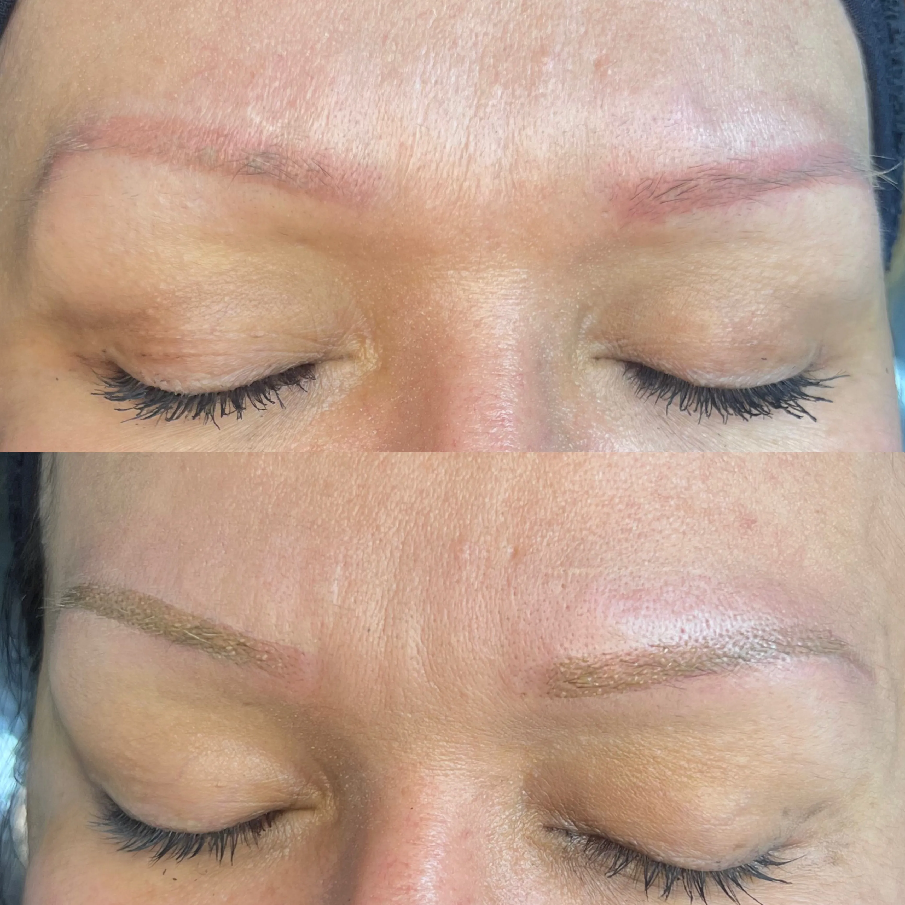   ***Neutralización De Cejas 