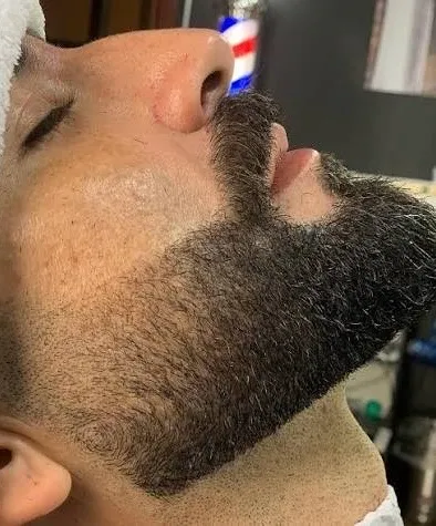 Perfilado de barba