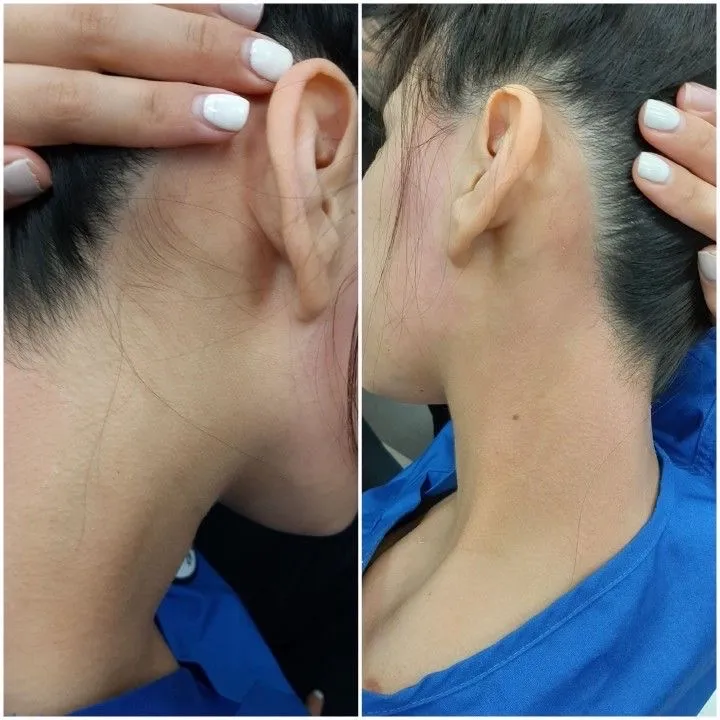 Epilaciòn Cuello💗