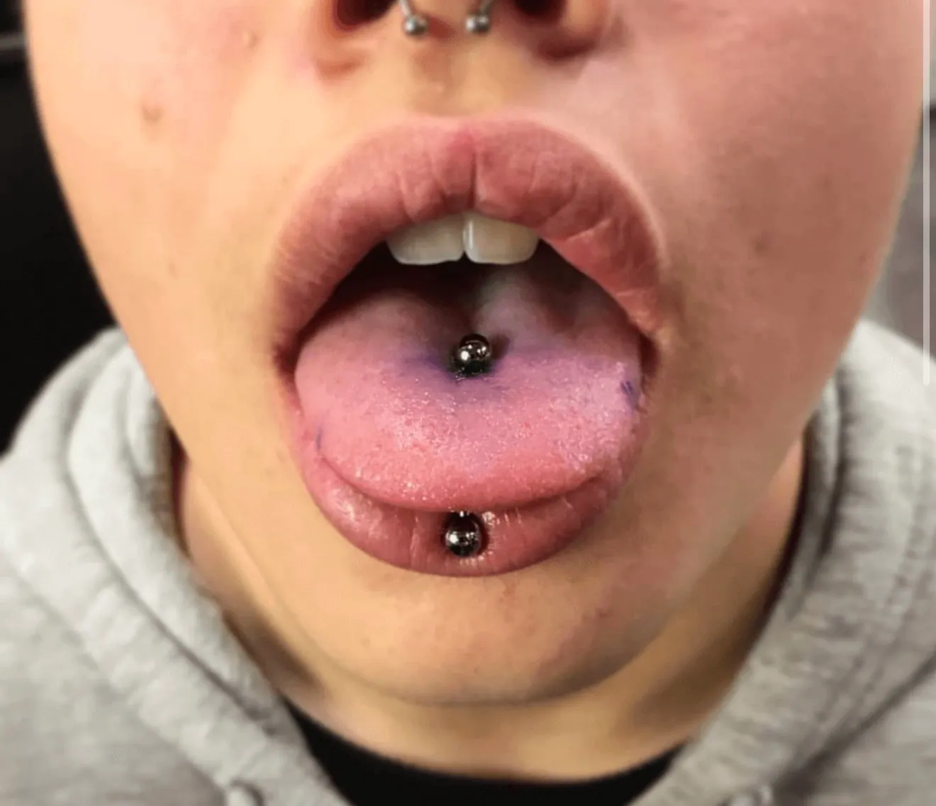 PERFORACIÓN LENGUA