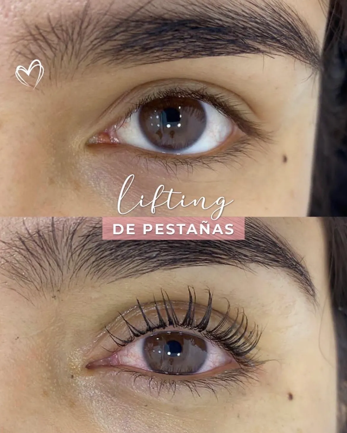 Lifting de pestañas