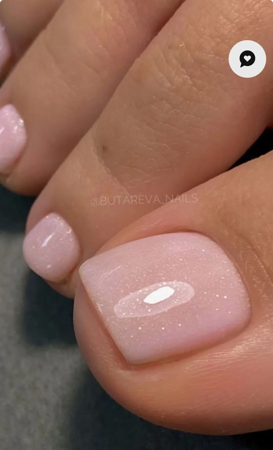 Retoque de acripie  - Imagen 1