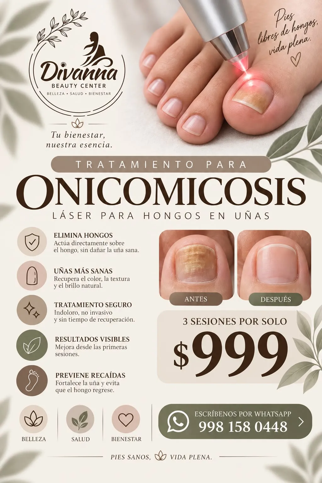 Tratamiento Laser Onicomicosis 3 Sesione