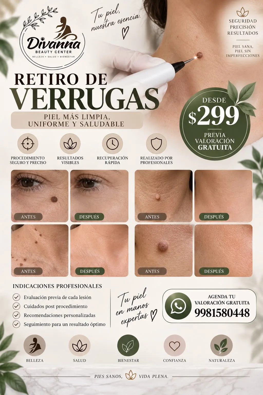 Retiro de Verrugas