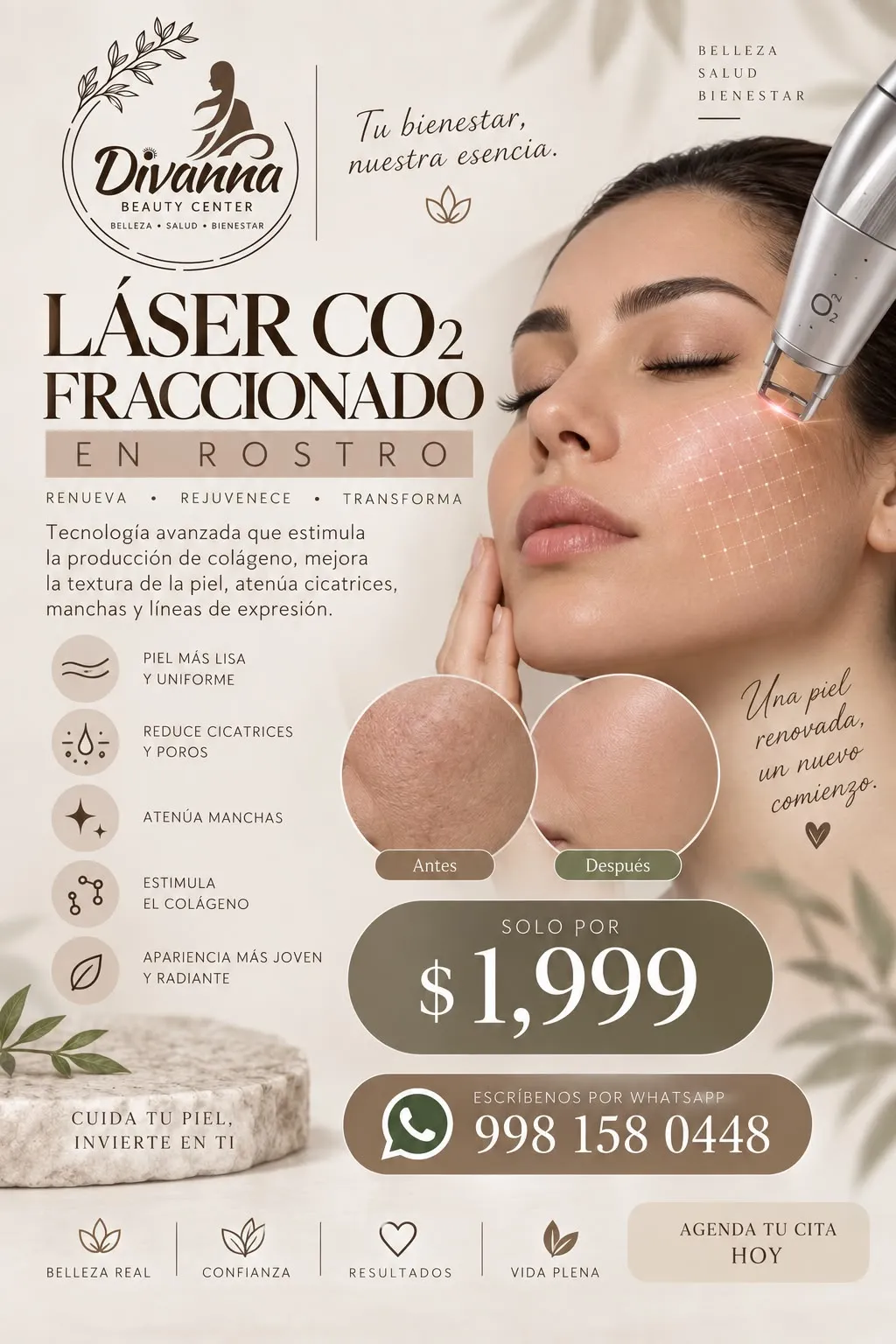 Laser CO2