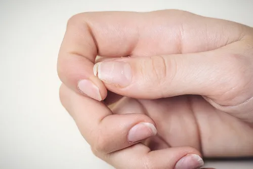 Reparación de Uñas