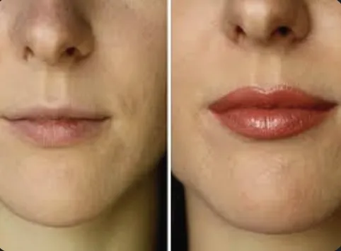 LINEA DE LABIO
