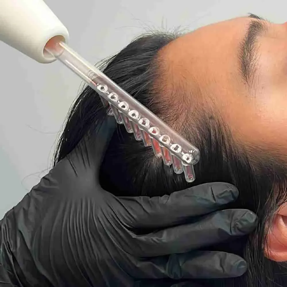 REPOLARIZACION - DAMA