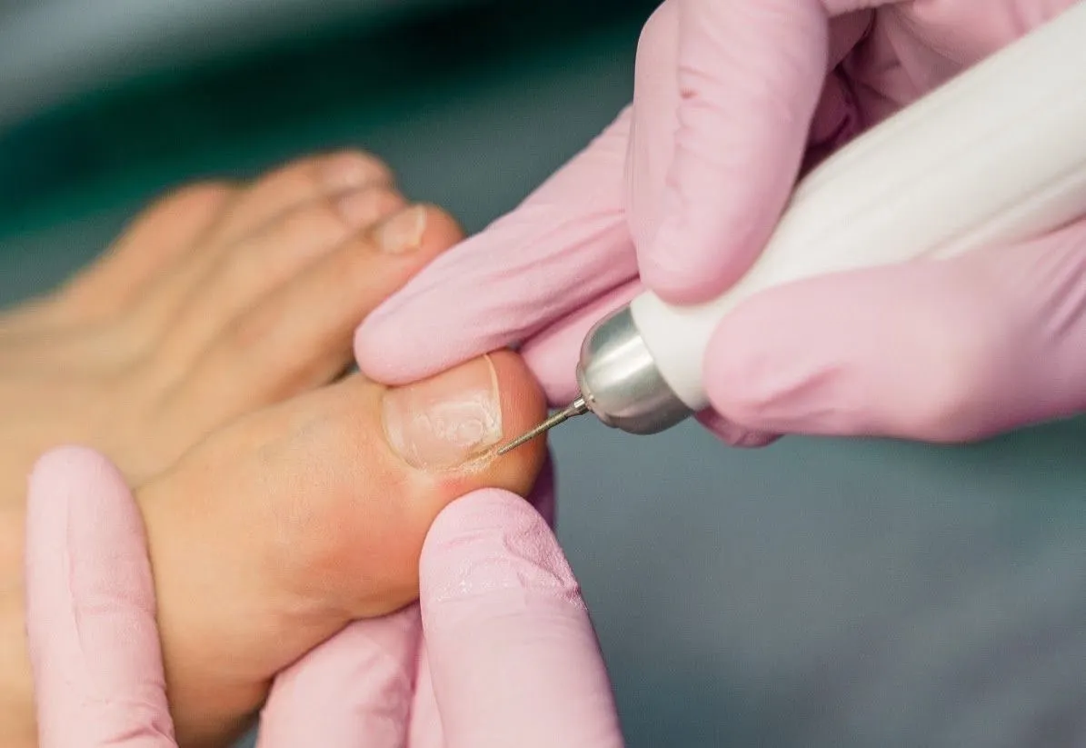 Podologia Preventiva