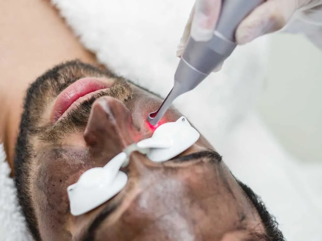 HOLLYWOOD PEEL - Imagen 1