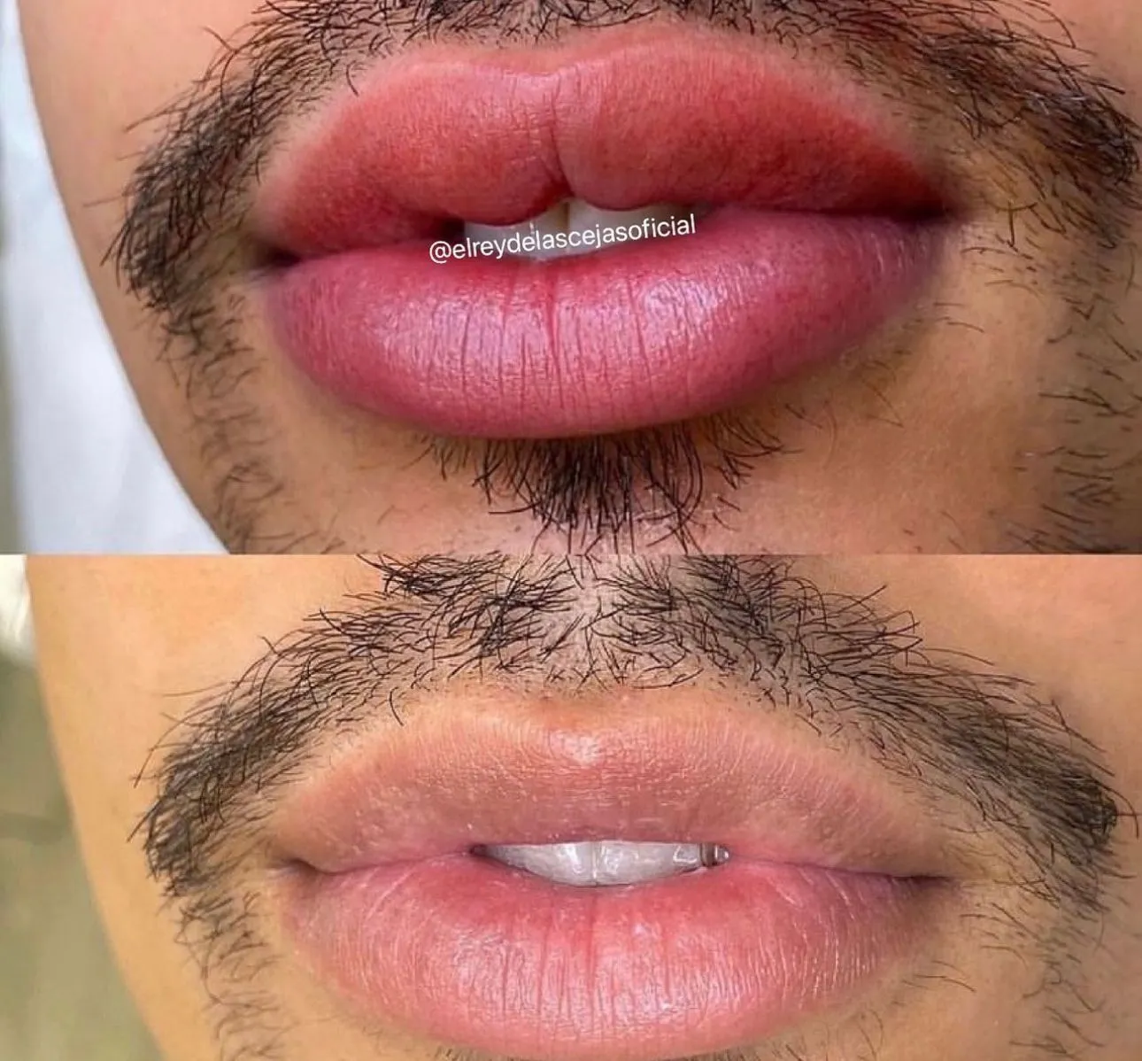 Micropigmentacion de Labios