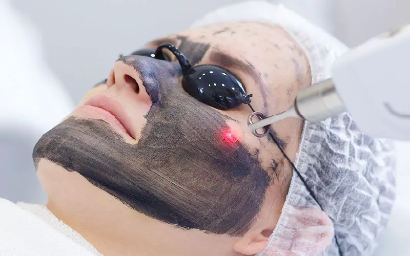 HOLLYWOOD PEEL - Imagen 2