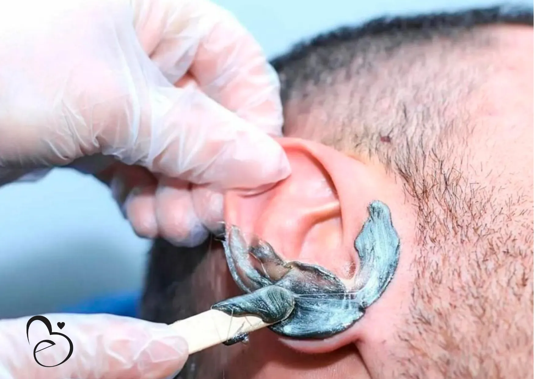 Depilacion de oidos - Imagen 1