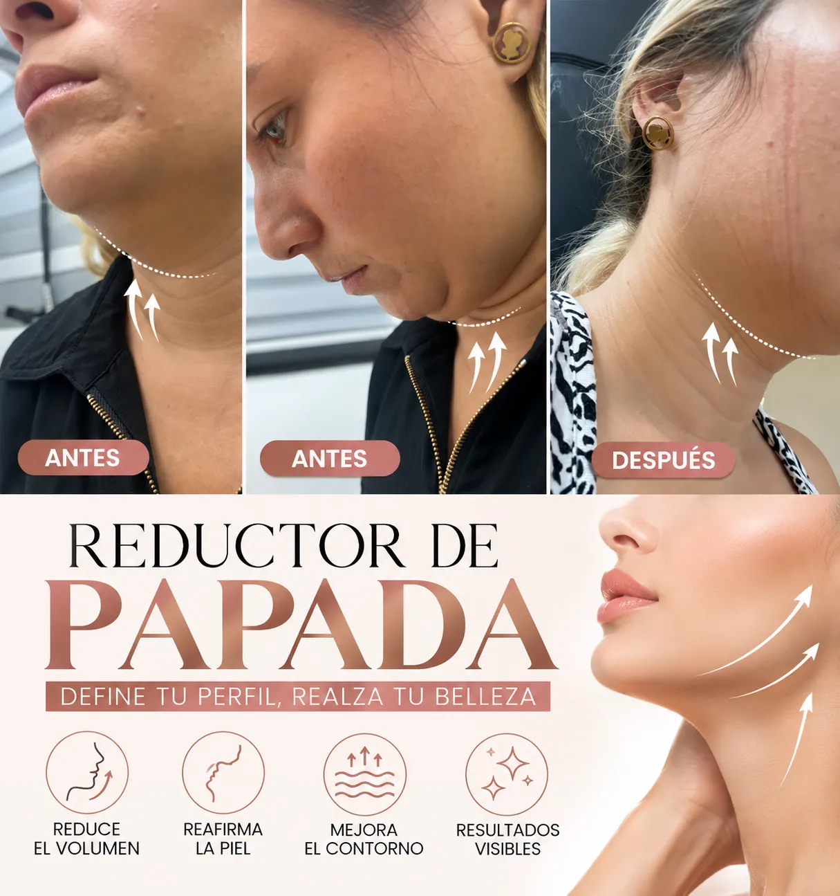 reductor de papada