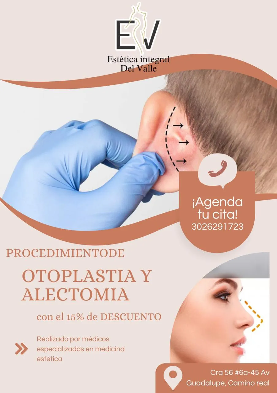 OTOPLASTIA - 3